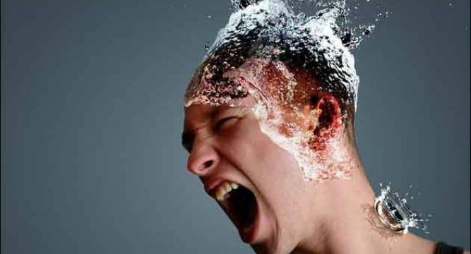 Suffering From Exploding Head Syndrome You Are Not Alone